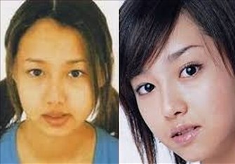 マジで整形やり過ぎてる！と思う芸能人は？