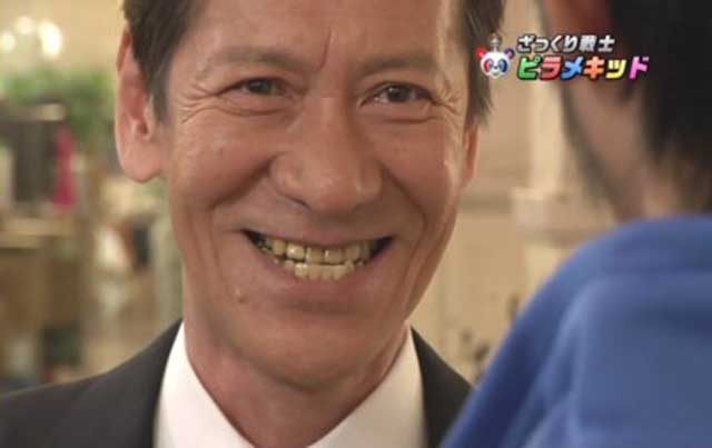 口元が残念な芸能人