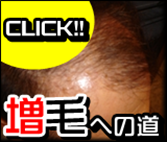   【凄ワザ】実に魅力的！m字ハゲと・おでこが広い人の髪型がイケメンに？ ｜ 【最前線】メンズ・ヘアビューティの頭皮改善