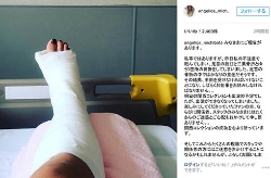 道端アンジェリカ、転倒して右足首骨折し手術へ　18日の関西コレクションはキャンセル