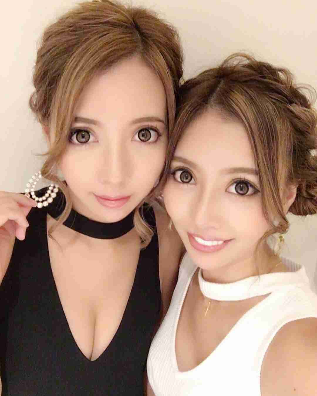 人気双子モデル・吉川ちえ&ちか、そろって整形手術再び「顎がはえたよん」