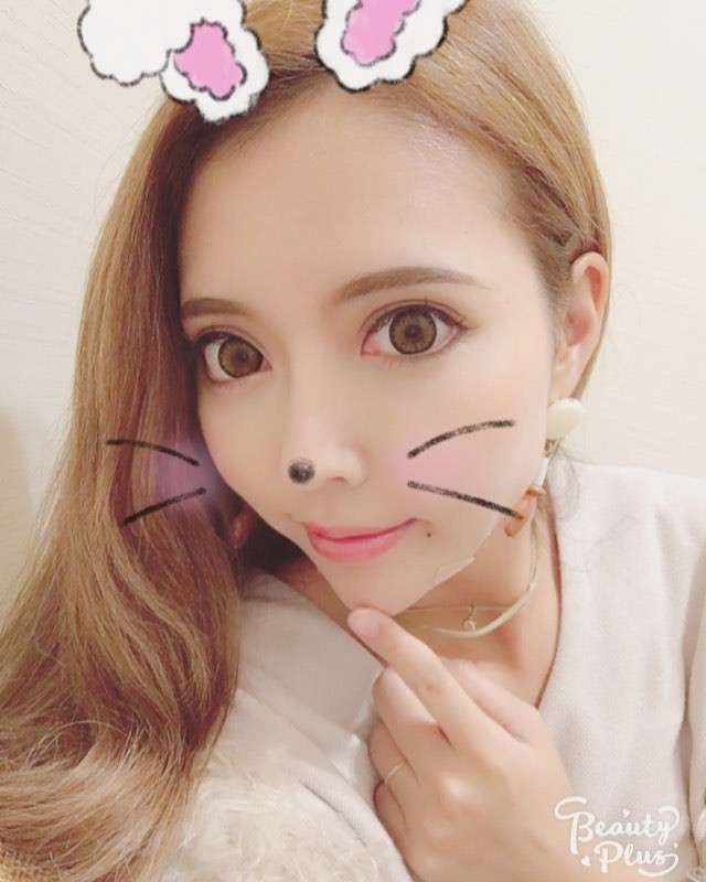 人気双子モデル・吉川ちえ&ちか、そろって整形手術再び「顎がはえたよん」