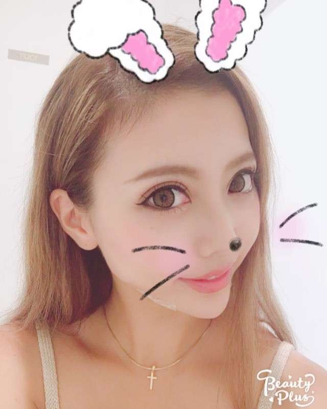 人気双子モデル・吉川ちえ&ちか、そろって整形手術再び「顎がはえたよん」