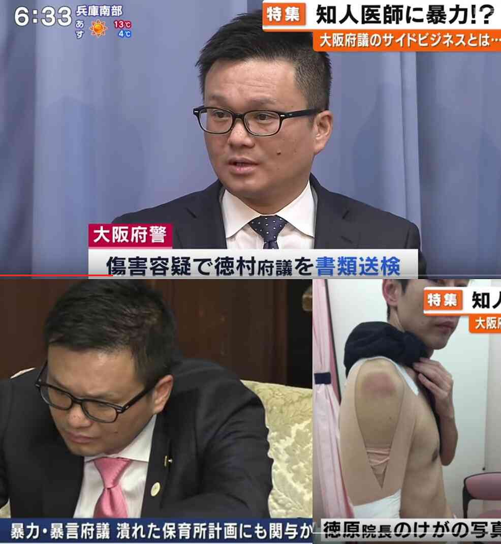 豊田真由子元衆院議員 傷害と暴行容疑で書類送検