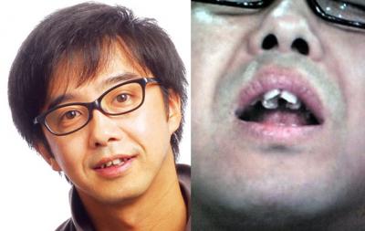 歯並びが悪い（悪かった）芸能人を挙げていくトピ