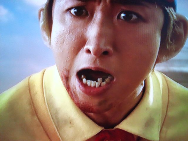 歯並びが悪い（悪かった）芸能人を挙げていくトピ