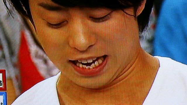 歯並びが悪い（悪かった）芸能人を挙げていくトピ