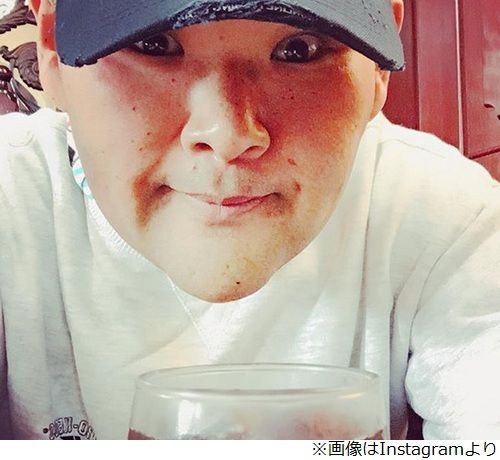 100キロ超減量の安田大サーカス・HIRO、痩せてから起こった体の変化