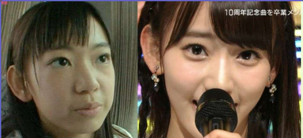 SKE48・須田亜香里、整形願望は「あります! 周りでしている人がいると…」