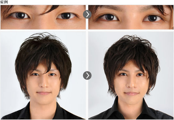 男も整形　ビフォーアフター写真集【女性だけじゃない】人生が変わる！？ - NAVER まとめ