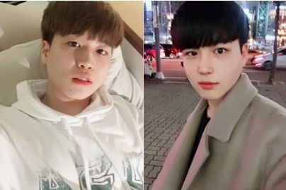 韓国男性SNSスターリアル美容整形ビフォーアフター!!｜韓国での美容整形は韓国id美容外科・韓国美容整形両顎、輪郭手術専門美容病院