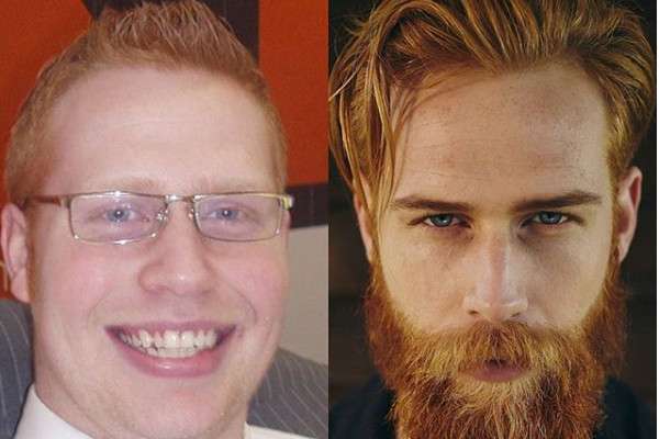 「ヒゲを生やしたら？」とアドバイスされたメタボ男性、現在はイケメンモデルに大変身を遂げる