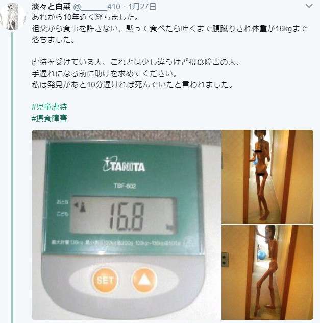 家族から食事を許されず餓死寸前だった日本人女性に海外から怒りと驚きの声「こんな目に遭わせる理由はいったい何なんだ」