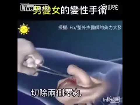 【医学】医学の力 性転換手術 3Dアニメーションノーカット - YouTube