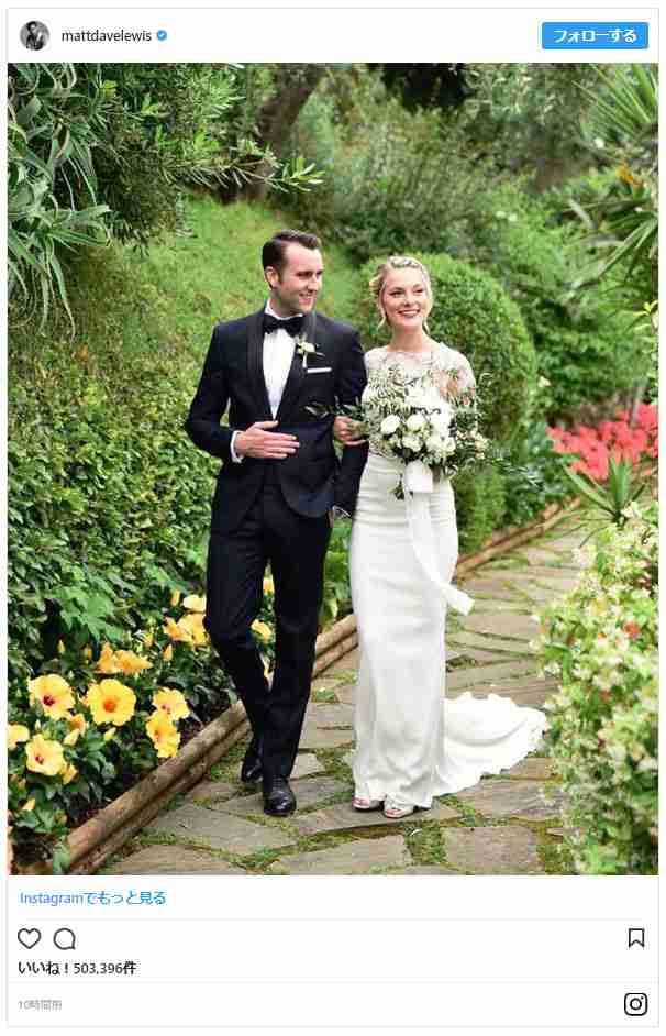 『ハリー・ポッター』ネビル俳優が結婚！出会いのきっかけもハリポタ