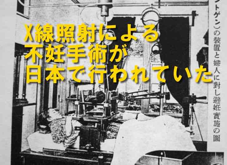 強制的にX線照射での不妊手術を受けた女性の記録ビデオ | 診療放射線技師ともきのブログ