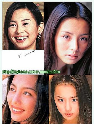 芸能人の整形アンケート調査【プラマイ】