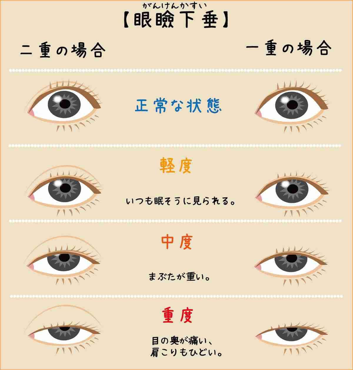 メガネではなくコンタクトにする理由 ガールズちゃんねる Girls Channel