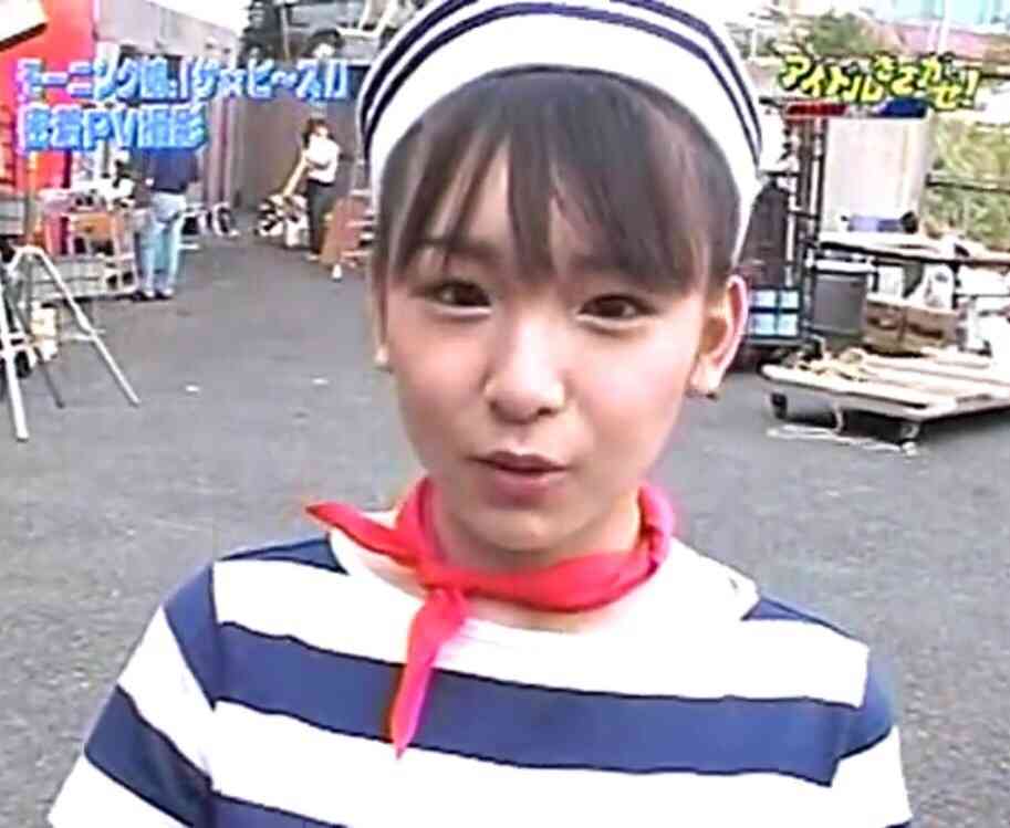 芸能人の整形アンケート調査【プラマイ】