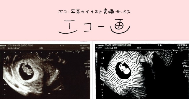 一生の宝物に！「赤ちゃんのエコー写真」をイラストに変換するサービス「エコー画」が可愛い♪ - ハピママ*