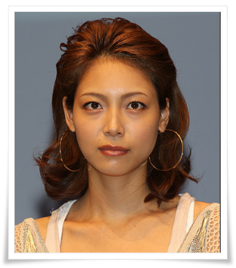 いまいちパッとしないと思う有名人