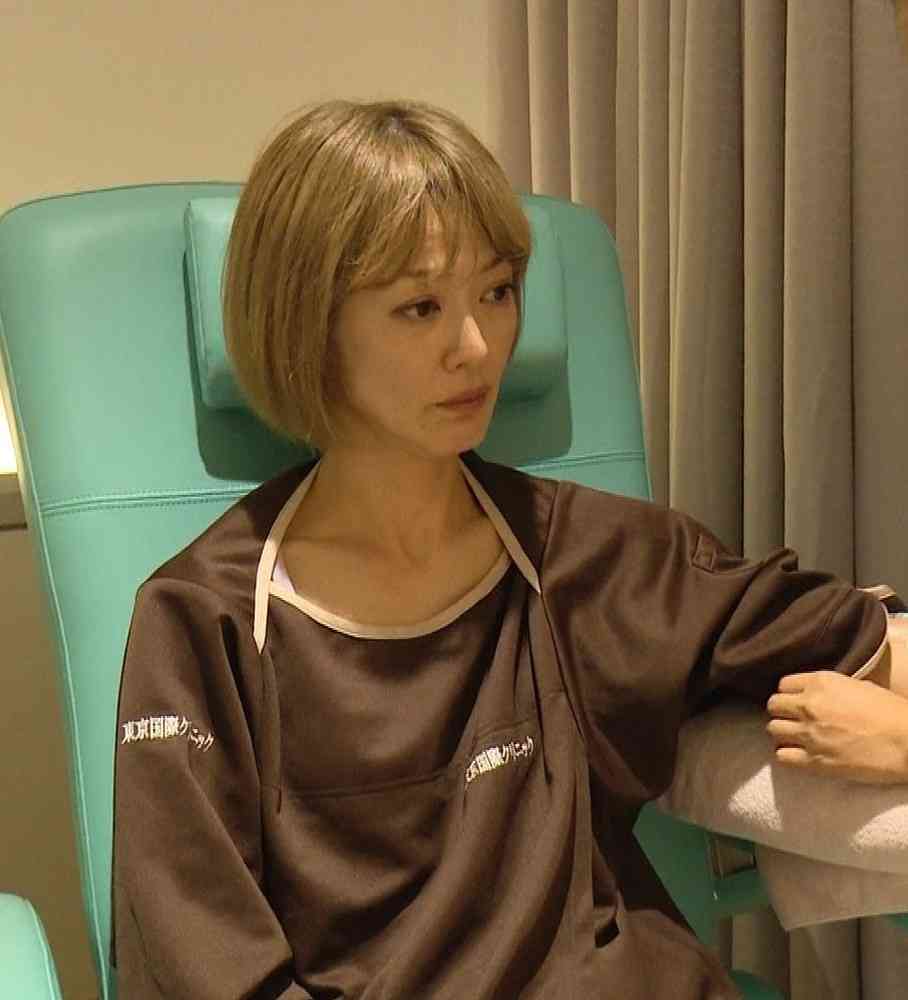 松嶋尚美に“余命13年”宣告　肺年齢は74歳…慢性閉塞性肺疾患が判明（スポニチアネックス） - Yahoo!ニュース