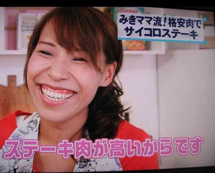 口元が気になる芸能人
