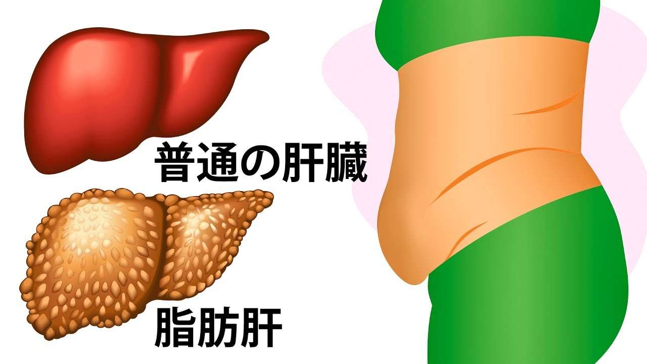 肝臓が助けを求めている10のサイン - YouTube