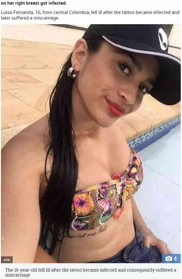 【海外発！Breaking News】胸にタトゥーを入れた16歳が感染症で車椅子生活に　お腹の子も流産（コロンビア） | Techinsight（テックインサイト）|海外セレブ、国内エンタメのオンリーワンをお届けするニュースサイト