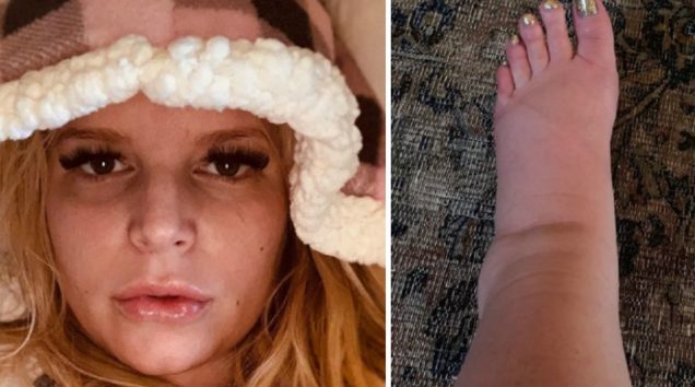 妊婦ジェシカ・シンプソン　驚異的に浮腫んだ足の写真公開にファン衝撃 – エトセトラ・ジャパン＜ETCETERA JAPAN＞