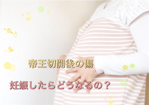 帝王切開での出産後の妊娠について