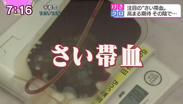 なぜ「さい帯血」は流出したのか？｜けさのクローズアップ｜NHKニュース　おはよう日本