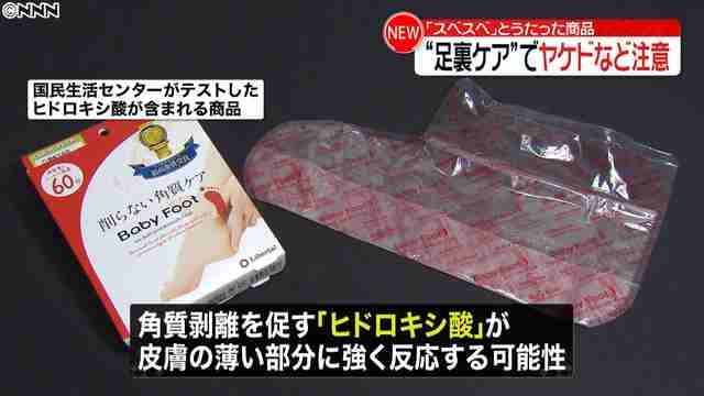 「足裏すべすべにする」フットケア商品に注意 化学ヤケドなど (2019年3月7日掲載) - ライブドアニュース