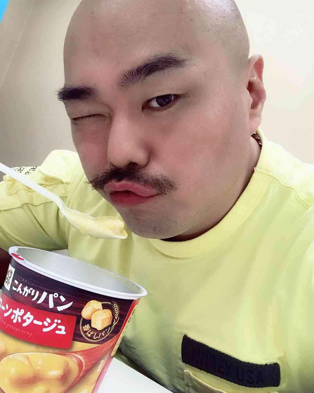 安田大サーカス・クロちゃん、“アヒル口”は板野友美の影響