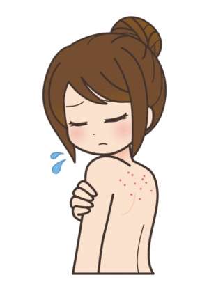 背中のニキビについて