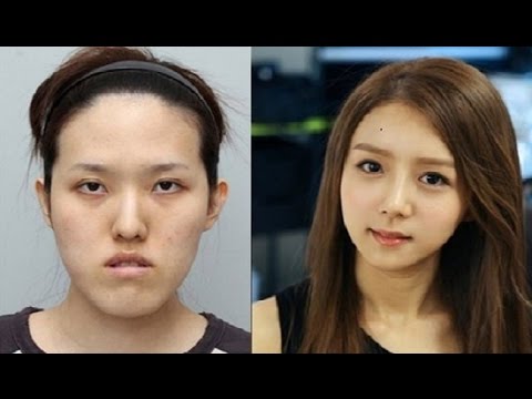 現役高校生の60%が「整形」に興味 したいのは「目」よりも「鼻」