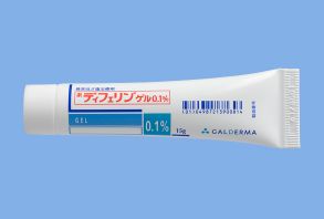 大人ニキビを治したい！