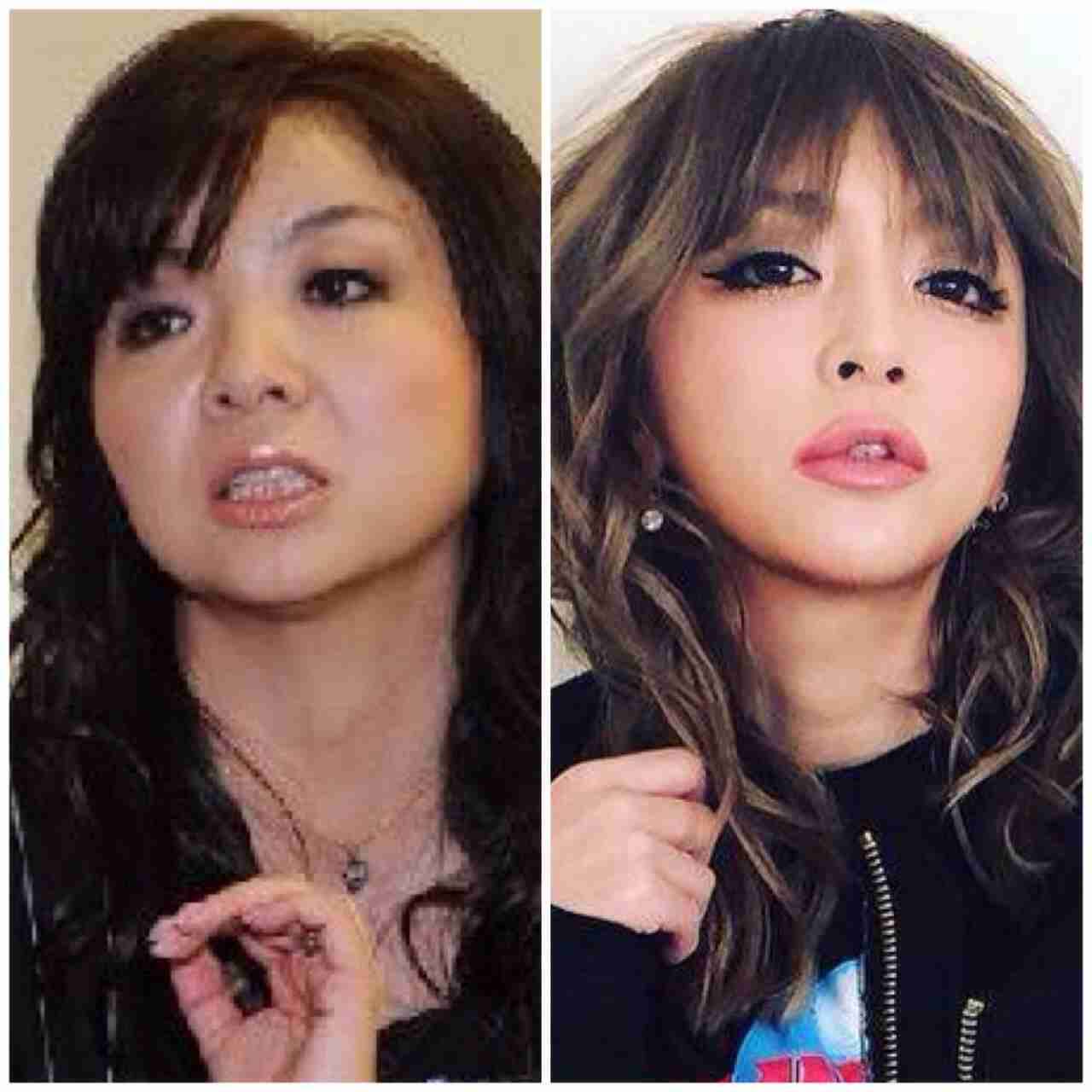浜崎あゆみ、ライブのステージ衣装に批判殺到「安室奈美恵のパクリ」「これはひどい」 