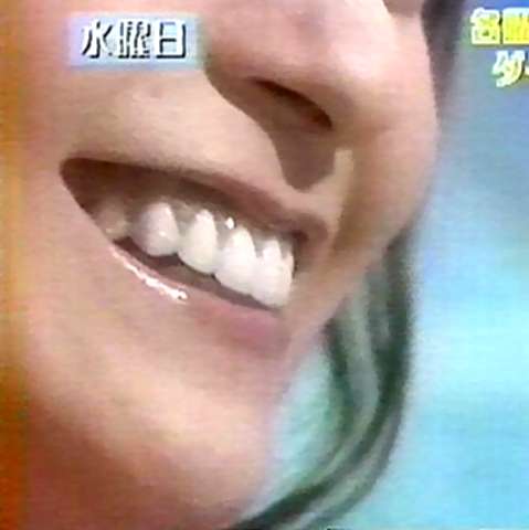 歯茎をピンクにしたい