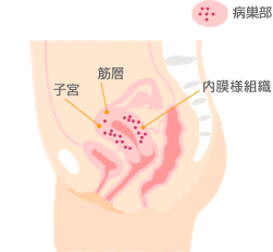 排卵痛で激痛…ひどいとき、薬や漢方は ...
