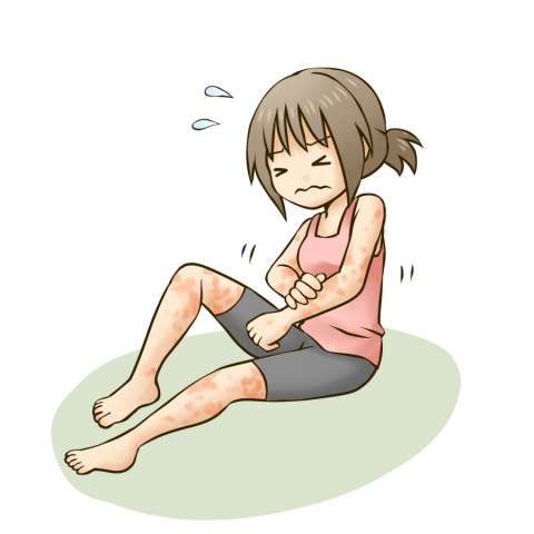 蕁麻疹(じんましん)が出た原因、わかりましたか？