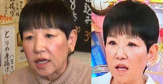 木村拓哉にまさかの