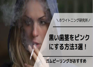 【歯茎が黒い】黒ずみの原因と歯茎をピンクにする方法3選を美容家が徹底解説 | ホワイトニング研究所