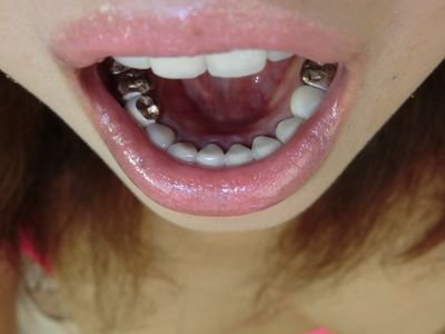 口臭キツイ人対策どうしてますか?