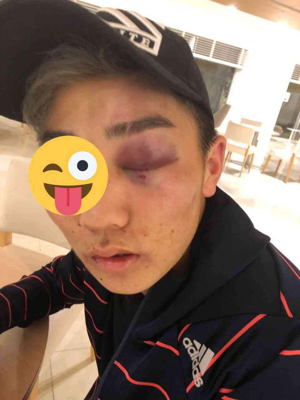 　☆　【名古屋】　　プロボクサーの少年を素手で殴り、両目に怪我を負わせた、とび職の少年を傷害容疑で逮捕／愛知県警　！ : 芸能ニュース365