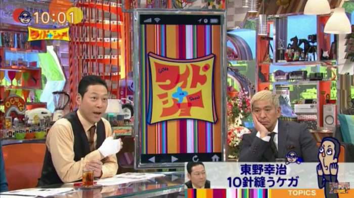 東野幸治、右手に10針縫うけが「『ゼルダの伝説』やりたくて急いでいた」