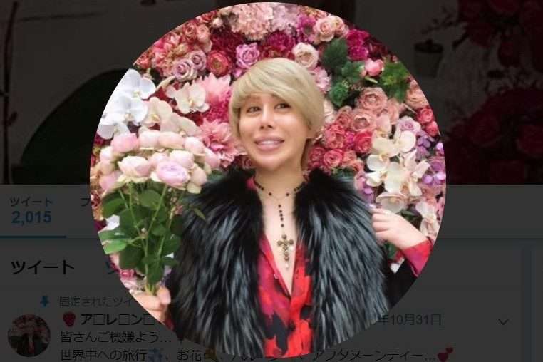 整形男子アレン ストイックすぎる美意識 老化を恐れて我慢しているものに驚愕 ガールズちゃんねる Girls Channel