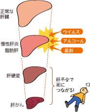 孤独死した30代女性の部屋に見た痛ましい現実