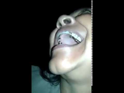 Milagre? Dente de Ouro ...Farsa ou verdade ?? - YouTube