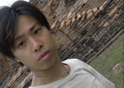 整形に9000万円！ 整形男子アレン、顔の激変と決意のワケを明かす